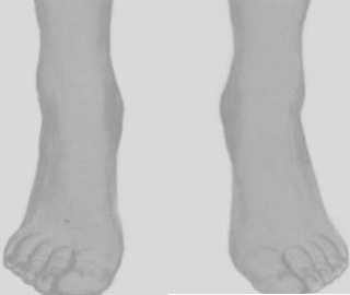 Two bare feet.
