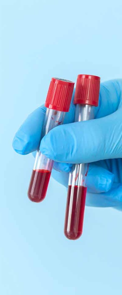 A gloved hand holding blood sample tubes
